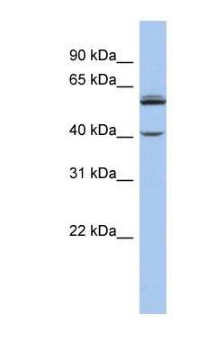 Western Blot: CYP4V2 Antibody [NBP1-60084]