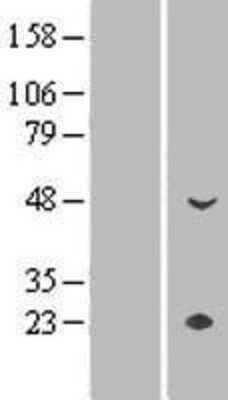 Western Blot: CYP4Z1 Overexpression Lysate [NBP2-04968]