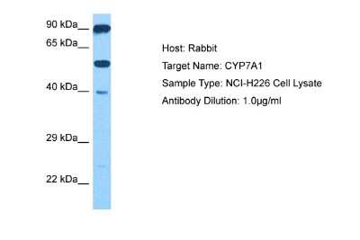 Western Blot: CYP7A1 Antibody [NBP2-83991]