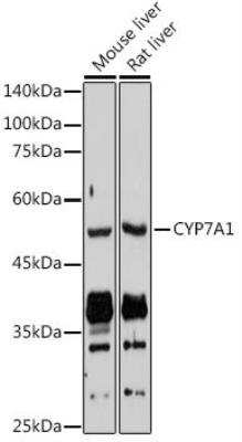 Western Blot: CYP7A1 AntibodyAzide and BSA Free [NBP3-04836]
