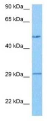 Western Blot: CYP7A1 Antibody [NBP3-10795]