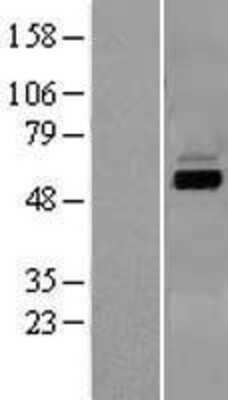 Western Blot: CYP7A1 Overexpression Lysate [NBL1-09704]
