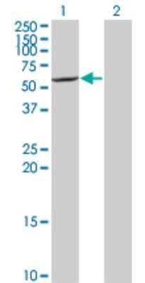 Western Blot: CYP7B1 Antibody (2B11) [H00009420-M06]