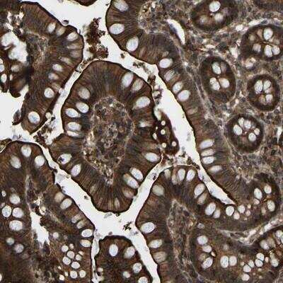 Immunohistochemistry: CYP7B1 Antibody [NBP1-87013]