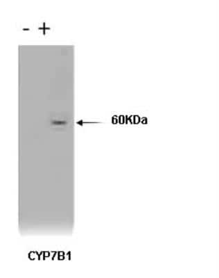 Western Blot: CYP7B1 Antibody (M17-P3F2)BSA Free [NBP2-50217]