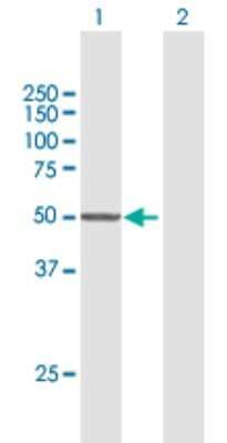 Western Blot: CYP7B1 Antibody [H00009420-B01P]