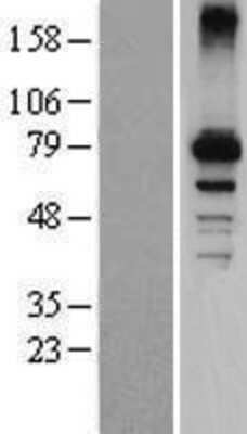 Western Blot: CYP7B1 Overexpression Lysate [NBP2-07820]