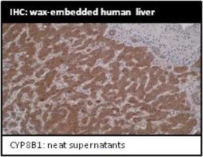 Immunohistochemistry: CYP8B1 Antibody (M15-P3B7) - BSA Free [NBP2-50218]