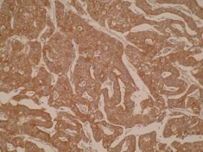 Immunohistochemistry: CYP8B1 Antibody (M15-P3B7) - BSA Free [NBP2-50218]