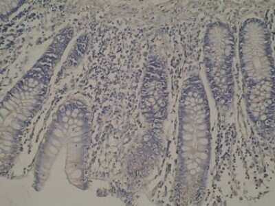 Immunohistochemistry: CYP8B1 Antibody (M15-P3B7) - BSA Free [NBP2-50218]