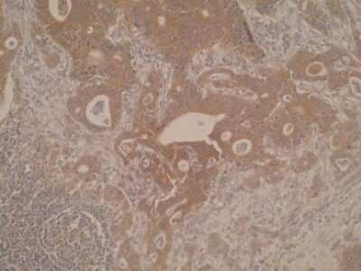 Immunohistochemistry: CYP8B1 Antibody (M15-P3B7) - BSA Free [NBP2-50218]