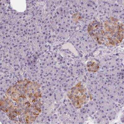 Immunohistochemistry-Paraffin: CYRPTIC/CFC1 Antibody [NBP2-14473]