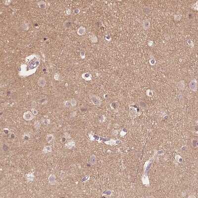 Immunohistochemistry-Paraffin: CYRPTIC/CFC1 Antibody [NBP2-14473]