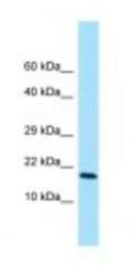 Western Blot: CYRPTIC/CFC1 Antibody [NBP1-98527]