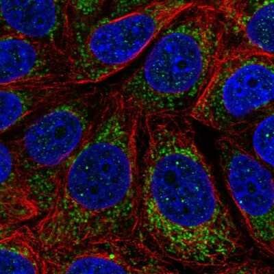 Immunocytochemistry/ Immunofluorescence: CYTB Antibody [NBP2-57841]