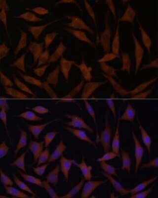 Immunocytochemistry/ Immunofluorescence: CYTB Antibody - Azide and BSA Free [NBP2-92639]