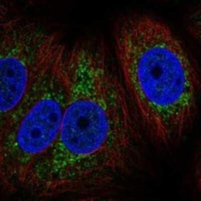 Immunocytochemistry/ Immunofluorescence: CYTB Antibody [NBP3-17828]