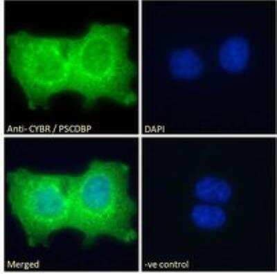 Immunofluorescence: CYTIP Antibody [NB100-1002]
