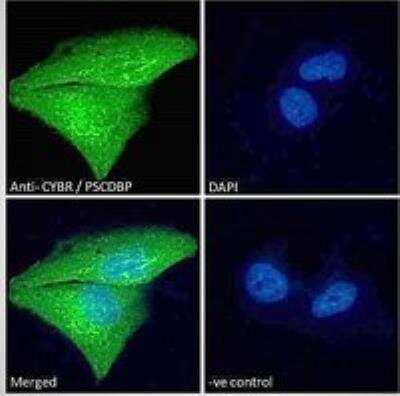 Immunofluorescence: CYTIP Antibody [NB100-1002]