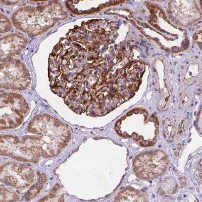 Immunohistochemistry-Paraffin: CYYR1 Antibody [NBP2-49526]