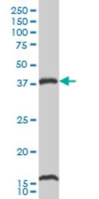 Western Blot: CaM Kinase I Antibody (2B6) [H00008536-M02]