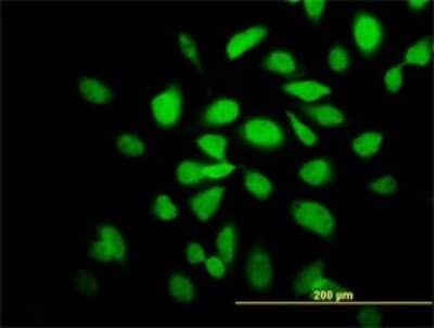 Immunocytochemistry/ Immunofluorescence: CaM Kinase II alpha Antibody (2C4) [H00000815-M01]