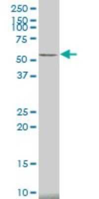 Western Blot: CaM Kinase II alpha Antibody (2C4) [H00000815-M01]