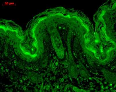 Immunocytochemistry/ Immunofluorescence: CaM Kinase II alpha Antibody (6G9) [NB100-1983]