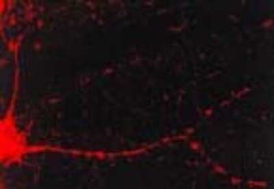 Immunocytochemistry/ Immunofluorescence: CaM Kinase II alpha Antibody (6G9) [NB100-1983]
