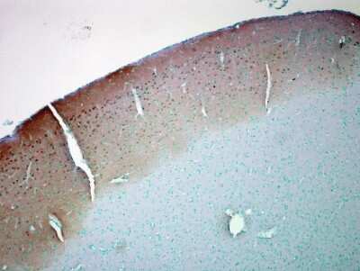 Immunohistochemistry: CaM Kinase II alpha Antibody (6G9) [NB100-1983]