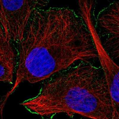 Immunocytochemistry/ Immunofluorescence: CaM Kinase II alpha Antibody [NBP2-46796]