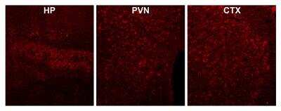 Immunohistochemistry: CaM Kinase II alpha Antibody [NBP1-51945]