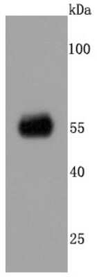 Western Blot: CaM Kinase II alpha Antibody (JM11-07) [NBP2-67207]
