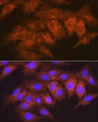 Immunocytochemistry/ Immunofluorescence: CaM Kinase II delta Antibody (10M1P2) [NBP3-16783]