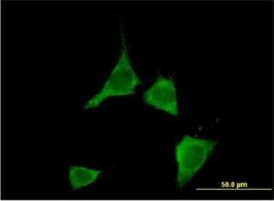 Immunocytochemistry/ Immunofluorescence: CaM Kinase II delta Antibody (1A8) [H00000817-M02]