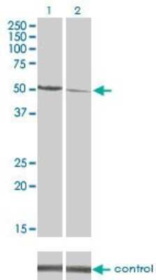 Western Blot: CaM Kinase II delta Antibody (1A8) [H00000817-M02]
