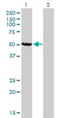 Western Blot: CaM Kinase II delta Antibody (1A8) [H00000817-M02]