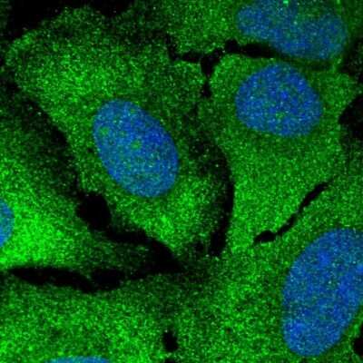 Immunocytochemistry/ Immunofluorescence: CaM Kinase II gamma Antibody [NBP2-57797]