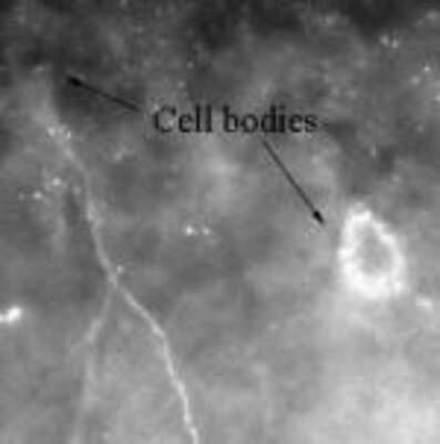 Immunocytochemistry/ Immunofluorescence: CaMKII beta Antibody [NB120-22131]