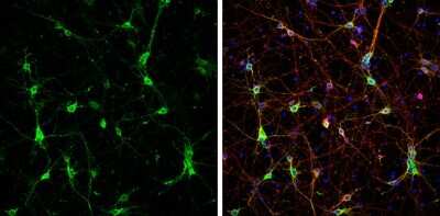 Immunocytochemistry/ Immunofluorescence: CaMKII beta Antibody [NBP3-13157]