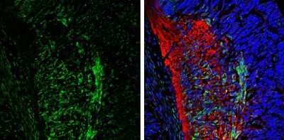Immunohistochemistry-Frozen: CaMKII beta Antibody [NBP3-13157]