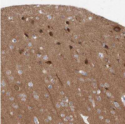 Immunohistochemistry-Paraffin: CaMKII beta Antibody [NBP1-88212]