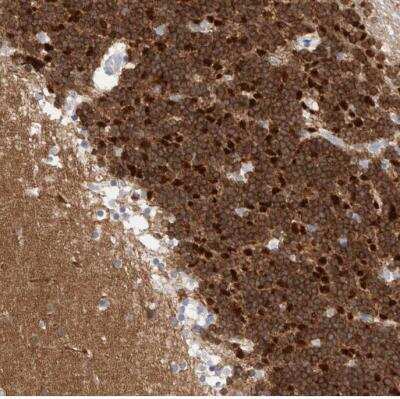 Immunohistochemistry-Paraffin: CaMKII beta Antibody [NBP1-88212]