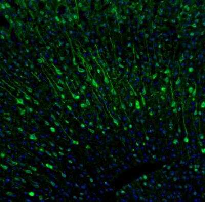 Immunohistochemistry: CaMKII beta Antibody [NBP1-88212]