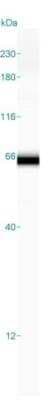 Simple Western: CaMKII beta Antibody [NBP1-88212]