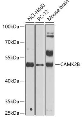 Western Blot: CaMKII beta AntibodyBSA Free [NBP2-92193]