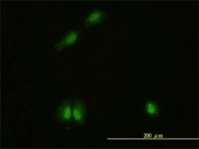 Immunocytochemistry/ Immunofluorescence: CaMKIV Antibody (1A3) [H00000814-M01]