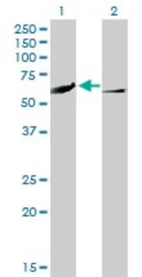 Western Blot: CaMKIV Antibody (1A3) [H00000814-M01]