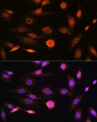 Immunocytochemistry/ Immunofluorescence: CaMKIV Antibody (1G4P4) [NBP3-16802]
