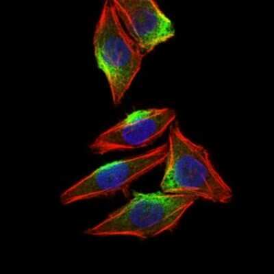 Immunocytochemistry/ Immunofluorescence: CaMKIV Antibody (8C5B8) - BSA Free [NBP2-37428]